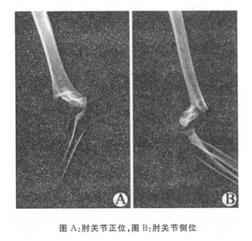 浏览器打开49图库